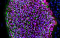 Células madre embrionarias derivadas de una persona con diabetes