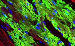 El implante de células humanas (en verde) contiene haces fibrilares y sarcómeros bien formados; células del huésped macaco en rojo.