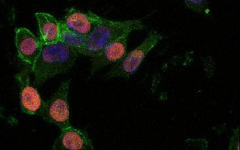 Imagen de la beta-catenina, clave para la regeneración de las células madre