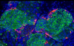 Imagen de las células beta productoras de insulina obtenidas en laboratorio.