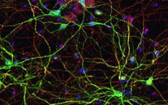 Imagen de las neuronas espinosas medias.